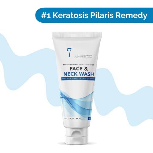 Microdermabrasion KP & Acne Scrub – Deep Cleansing Face & Body Exfoliant for Bumps, Redness, Rough & Dry Skin, Back & Butt Wash