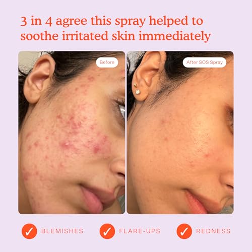 Tower 28 SOS Daily Rescue Facial Spray – Hypochlorous Acid Toner for Sensitive Skin, Redness & Breakout Relief, 4 FL Oz Full-Size Spray