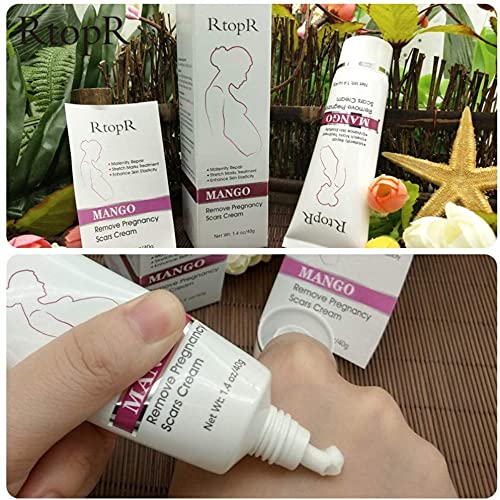 RtopR Mango Stretch Marks and Scar Cream -Stretch Marks and Scar Removal Cream for Pregnancy - Best Body Moisturizer-40g