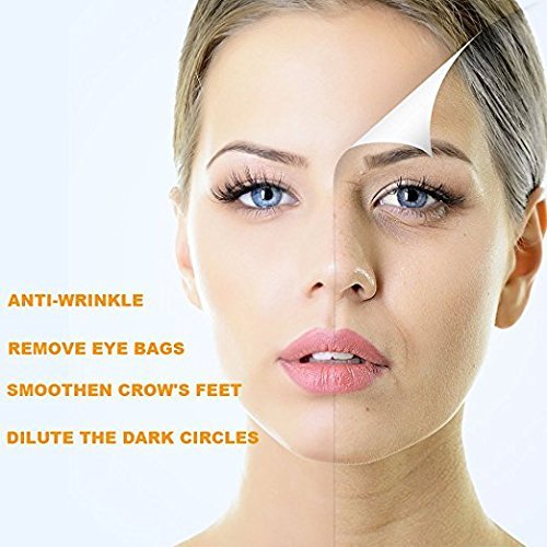 Anti-Aging Eye Gel for Dark Circles, Puffiness & Wrinkles โ Firming, Hydrating with Hyaluronic Acid & Aloe Vera, 1.7 fl. oz.