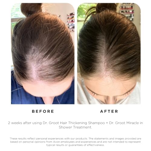 Dr. Groot Hair Thickening Shampoo with Biotin & Rosemary Oil – Volumizes Thinning Hair, Hydrates Scalp & Strengthens Damaged Hair, Korean Formula