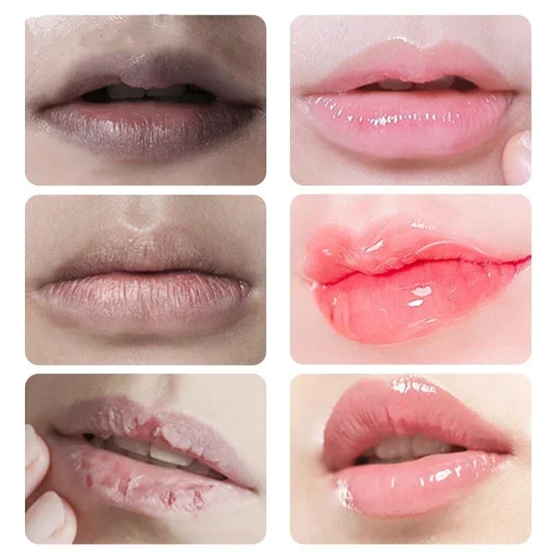 Lip Lightening Scrub Balm Fade Dull Lips Moisturizing Reduce Pigmentation Anti-Cracking Hyaluronic Acid Brighten Black Lips