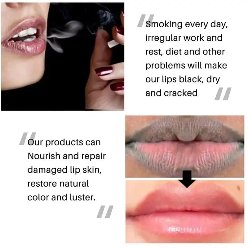Lips Pink Fresh Lightening Repair Remove Dark Smoke Lips Lip Balm Improve dark lips Moisturizing Nourishing Lip Care