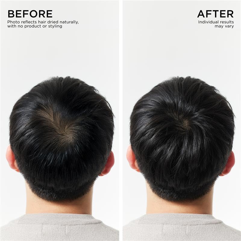 Dr. Groot Hair Thickening Conditioner – Biotin Scalp Treatment for Hair Loss & Thinning Hair, Korean Hair Care, Reduces Oil, Clinically Tested