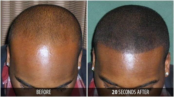 Dr. Yates MD Keratin Fiber Hair Enhancer (Dark Blonde)