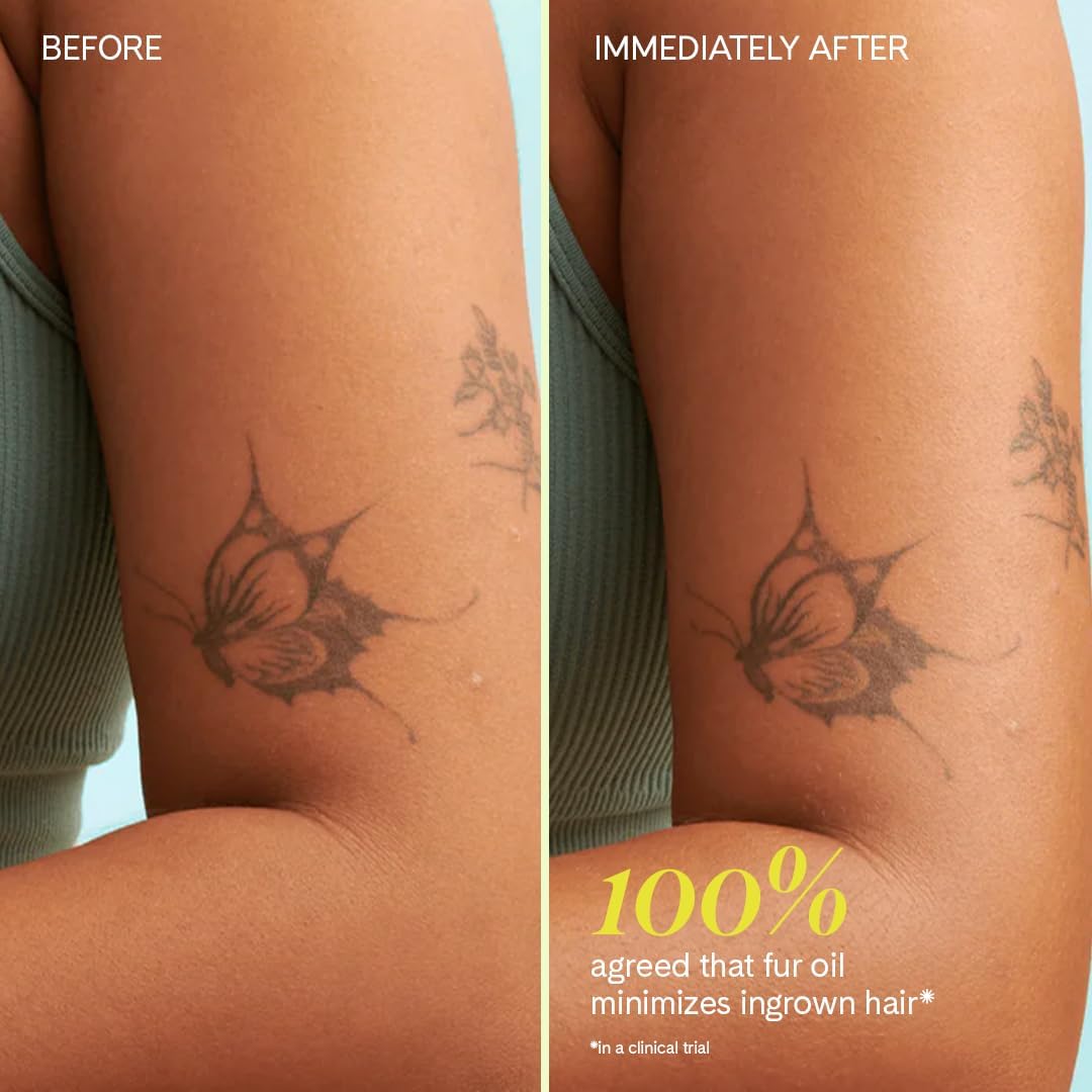 Ingrown Hair Oil 14mL – Soothes Razor Bumps, Prevents Ingrowns, Reduces Redness & Irritation with Jojoba, Clary Sage & Tea Tree