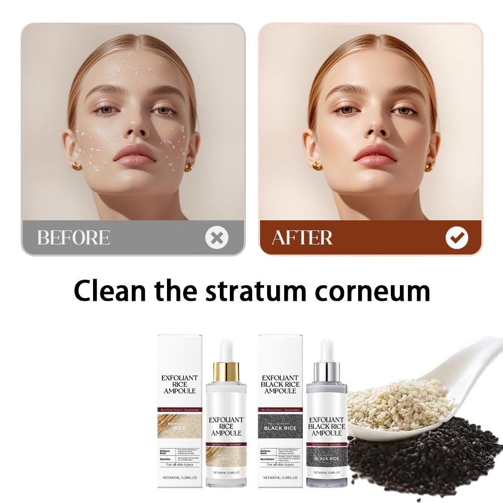 Black & White Rice Exfoliating Peel for Face & Body – Gentle Soft Scrub, Deep Hydration, Suitable for All Skin Types, 2-Pack