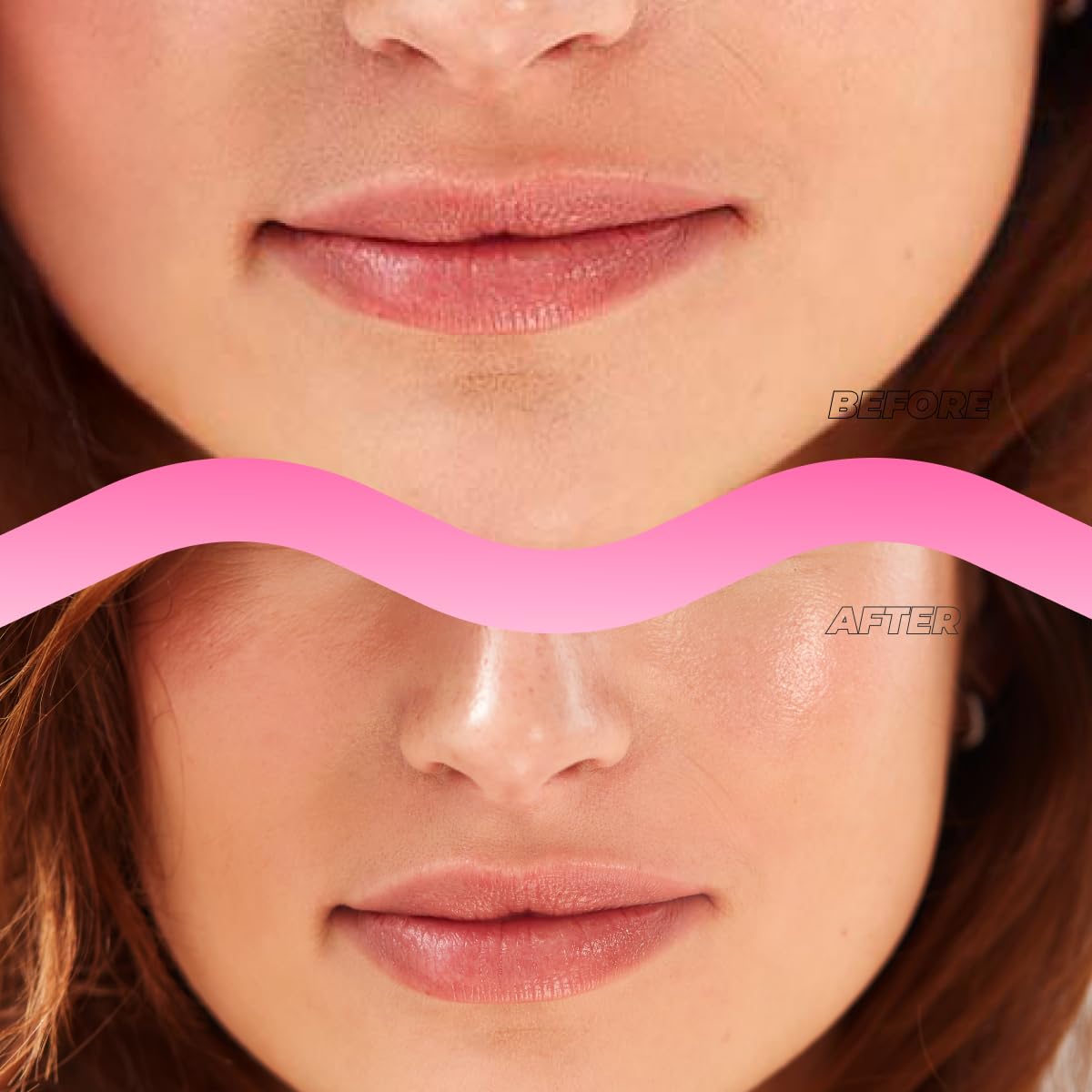 Instant Lip Filler Mask 3-Pack – Plump Lips in 30 Min with Vegan Collagen, Hyaluronic Acid & 400 Micro-Dart Patches, Korean Skincare