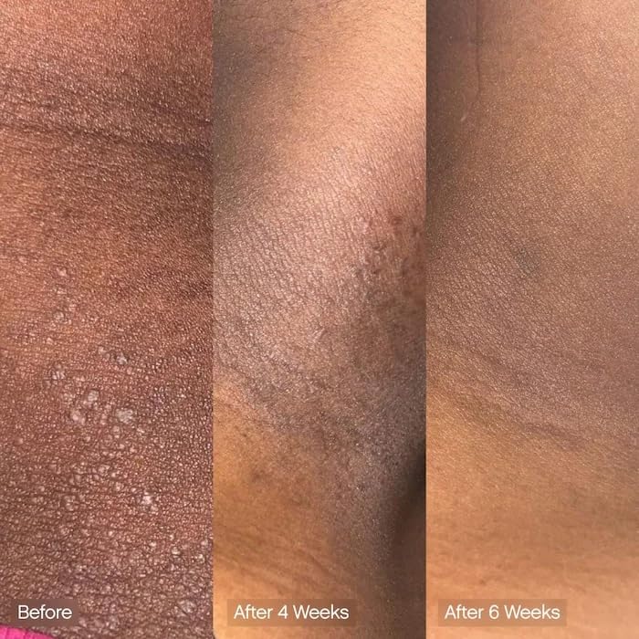 Faded Cleansing Bar for Face and Body | Kojic Acid, Vitamin C & Lactic Acid | Moisturizes | Vegan, Fragrance-Free, Safe for Sensitive Skin (2 Pack)