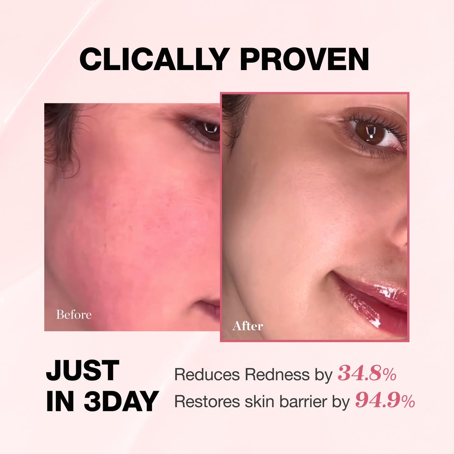 Physiogel Redness Reducing Cream – Ceramide Moisturizer for Sensitive, Redness-Prone Skin, Repairs Barrier, Fragrance-Free, 3.4 fl oz