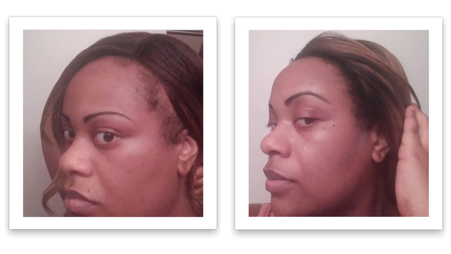 Caboki Hair Concealer (All-Natural Hair Building Fibers) Travel Size (Black)