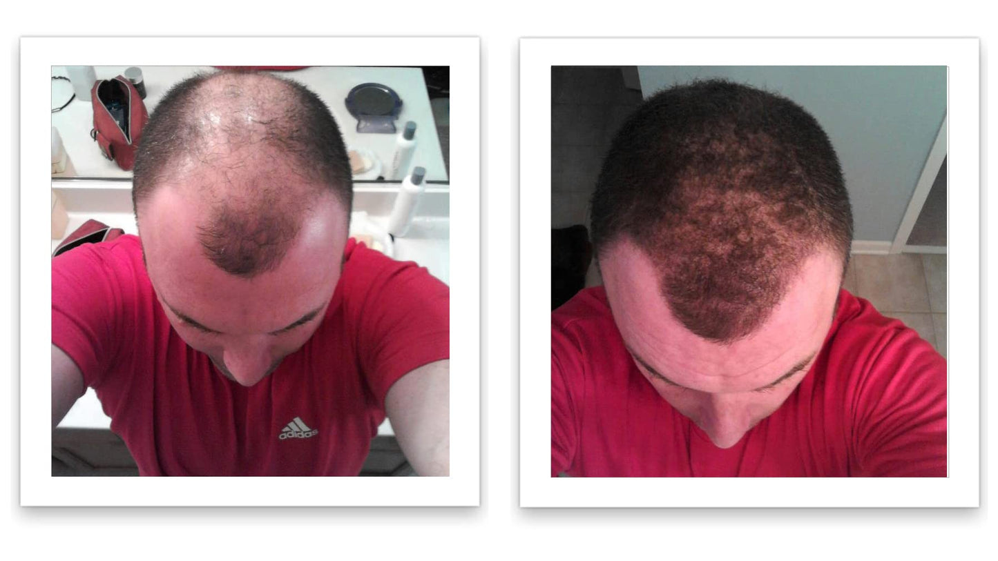 Caboki Hair Building Fiber 16G (Dark Brown)