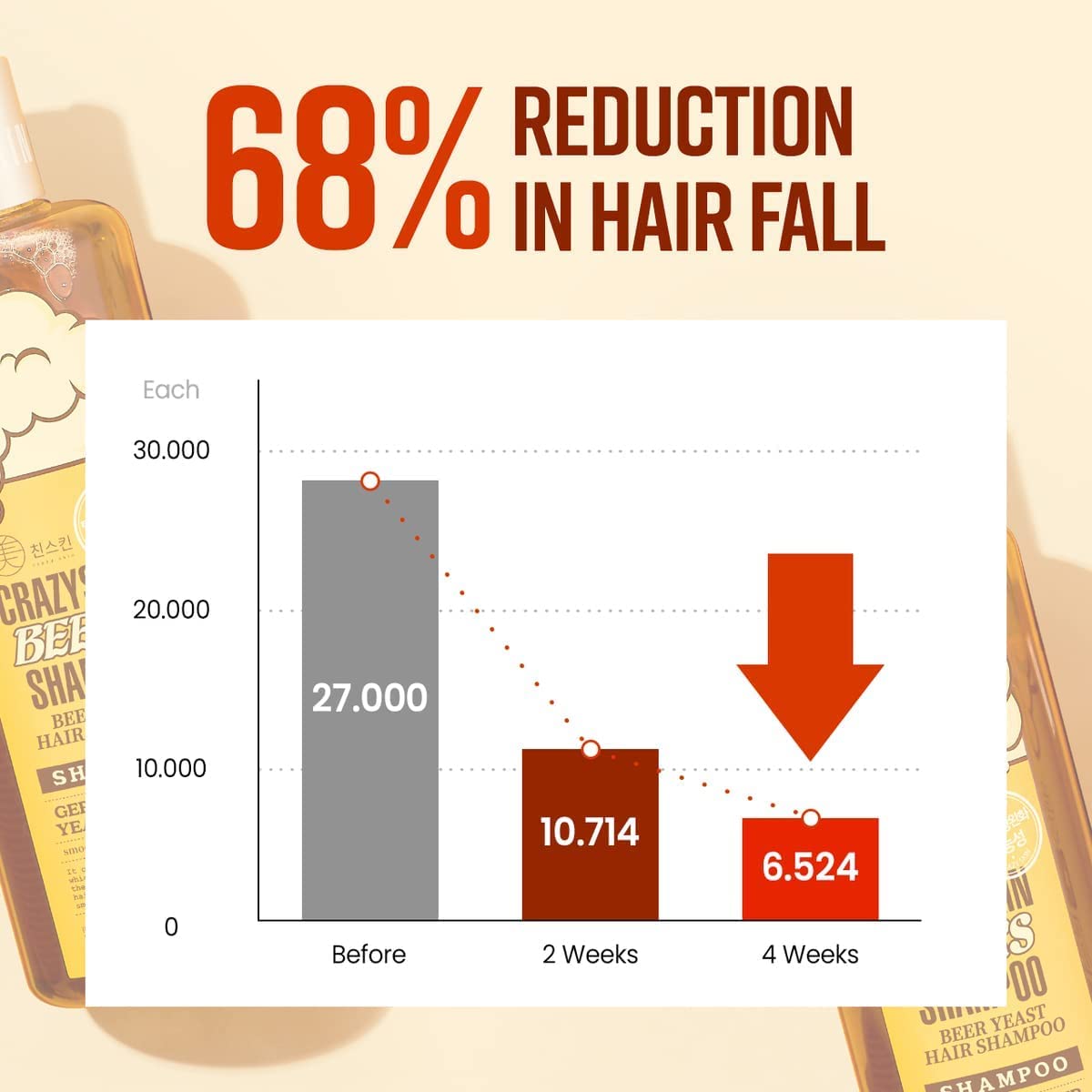 CRAZY SKIN German Beer Yeast Biotin Shampoo 300ml โ Anti-Hair Loss, Thickening, Hard Water Defense, Gentle Exfoliating, Sulfate-Free Formula