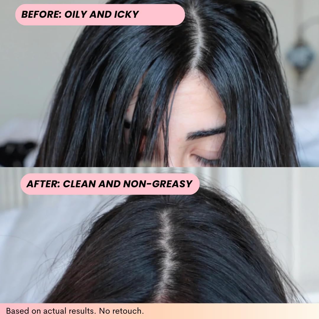 FoxyBae Volumizing Dry Shampoo Spray for Women - With Biotin for Hair Growth - For Dark, Brunette & Blonde Hair - Refreshing & Non-Toxic