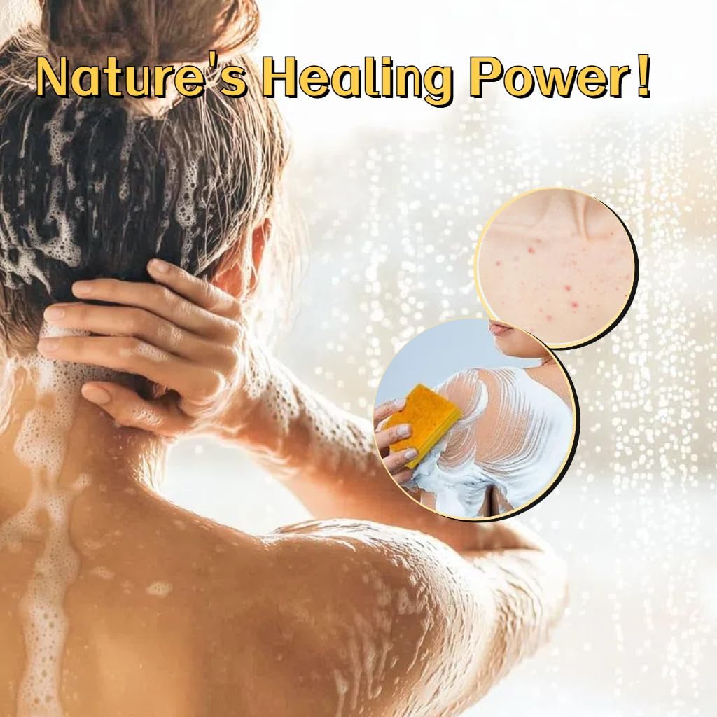 Uselective Kojic Acid & Turmeric Soap for Dark Spot Removal – Skin Lightening with Vitamin C, Retinol, Shea & Lemon Oil, SLS-Free