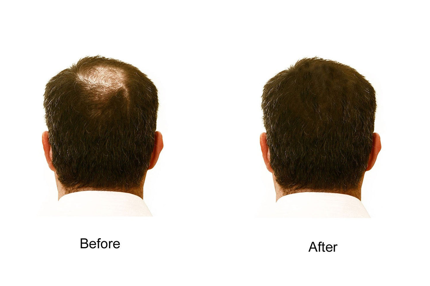 My Secret Hair Enhancer Medium Brown 5oz 3 pack