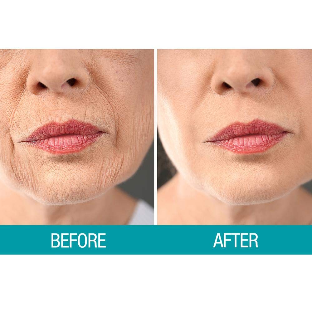 Dermactin-TS Crepe Be Gone Body Souffle 3 ounce (2-Pack)