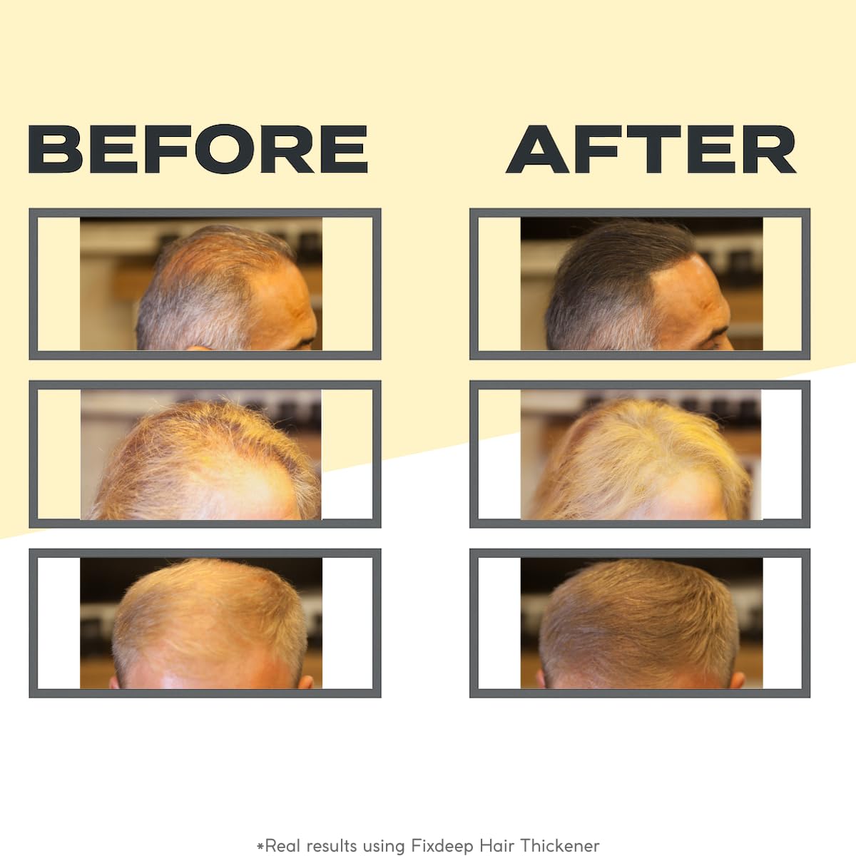 Fixdeep Hair Building Fibers for Thinning Hair (Black) | Waterproof, Sweat-Resistant | Instantly Fuller Hair in 30 Sec | Covers Bald Spots & Gray Roots, 14g