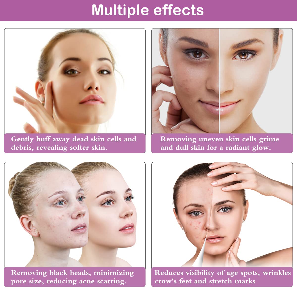 Diamond Microdermabrasion Machine, Yofuly 65-68cmHg Suction Power Professional Dermabrasion, Home Use Facial Skin Care Equipment