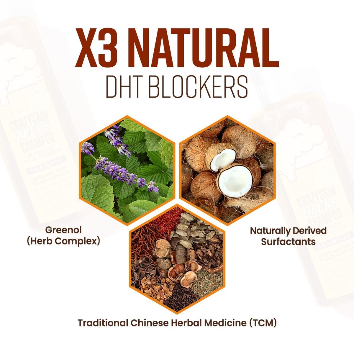 CRAZY SKIN German Beer Yeast Biotin Shampoo 300ml โ Anti-Hair Loss, Thickening, Hard Water Defense, Gentle Exfoliating, Sulfate-Free Formula