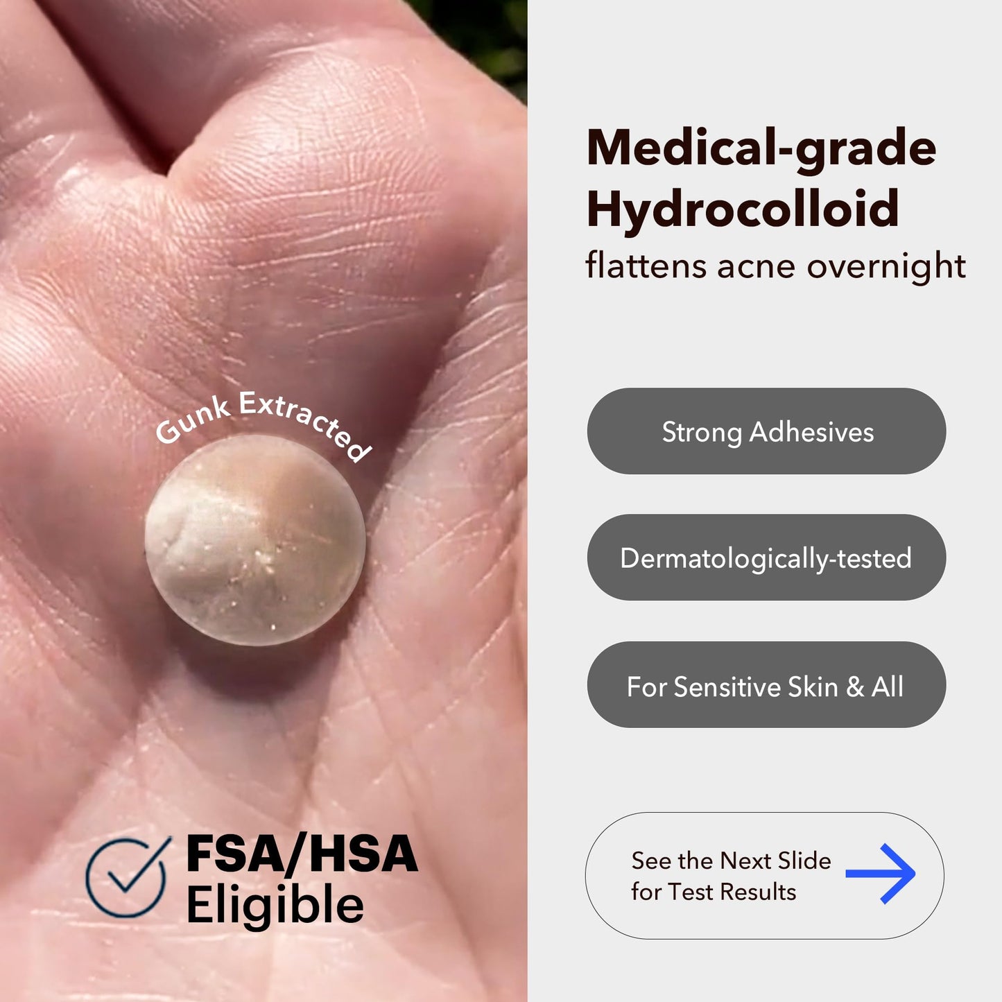 AVARELLE Acne Cover Patches with Tea Tree Oil – Korean Hydrocolloid Zit Patches for Face, Vegan & Cruelty-Free, HSA Eligible