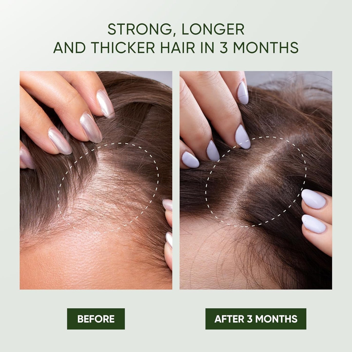 Svvimer Rosemary Hair Growth Shampoo with Biotin, Tea Tree Oil & Mint – Thickening Shampoo for Hair Loss & Thinning Hair – Men & Women, 11.8 Fl Oz