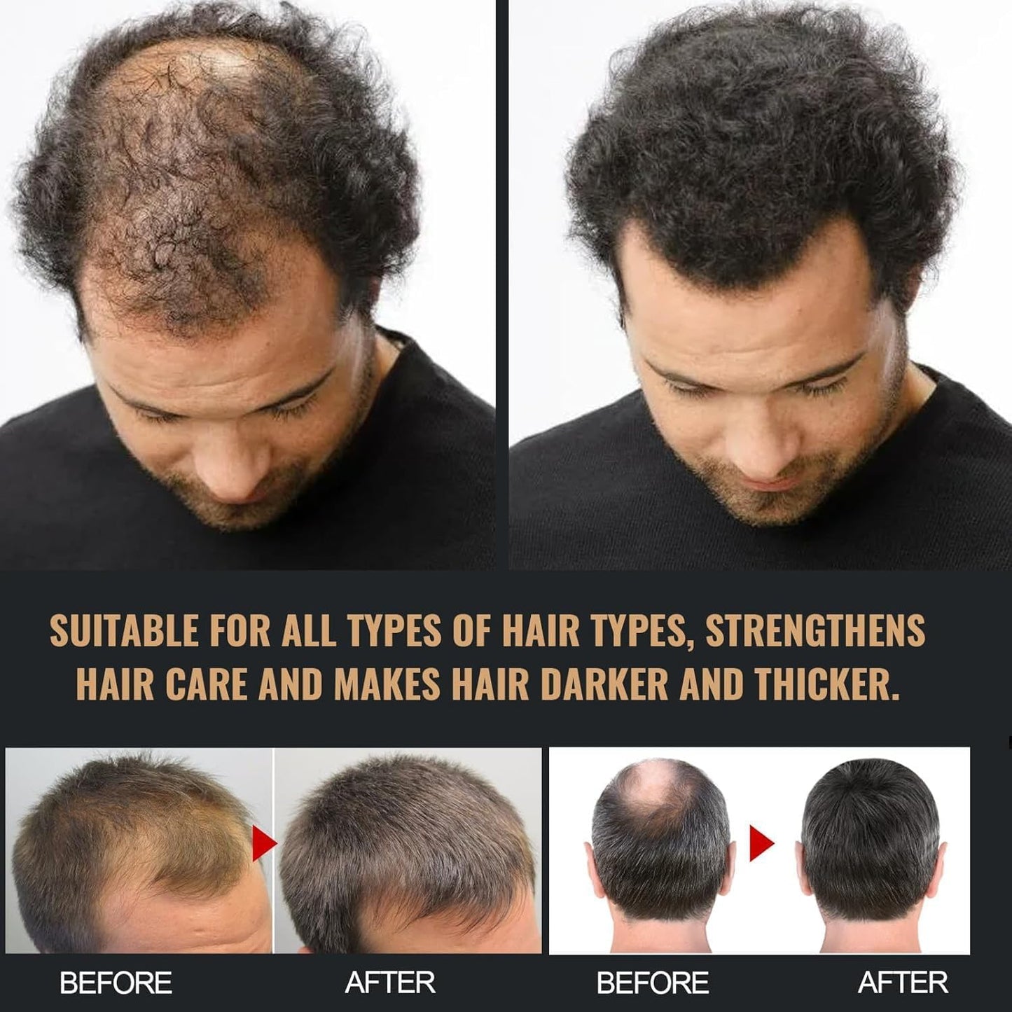 Spartan Root Activator Shampoo – Natural Hair Regrowth & Thickening Shampoo for Men & Women – Unisex Anti-Hair Loss Formula, 8.4 fl oz