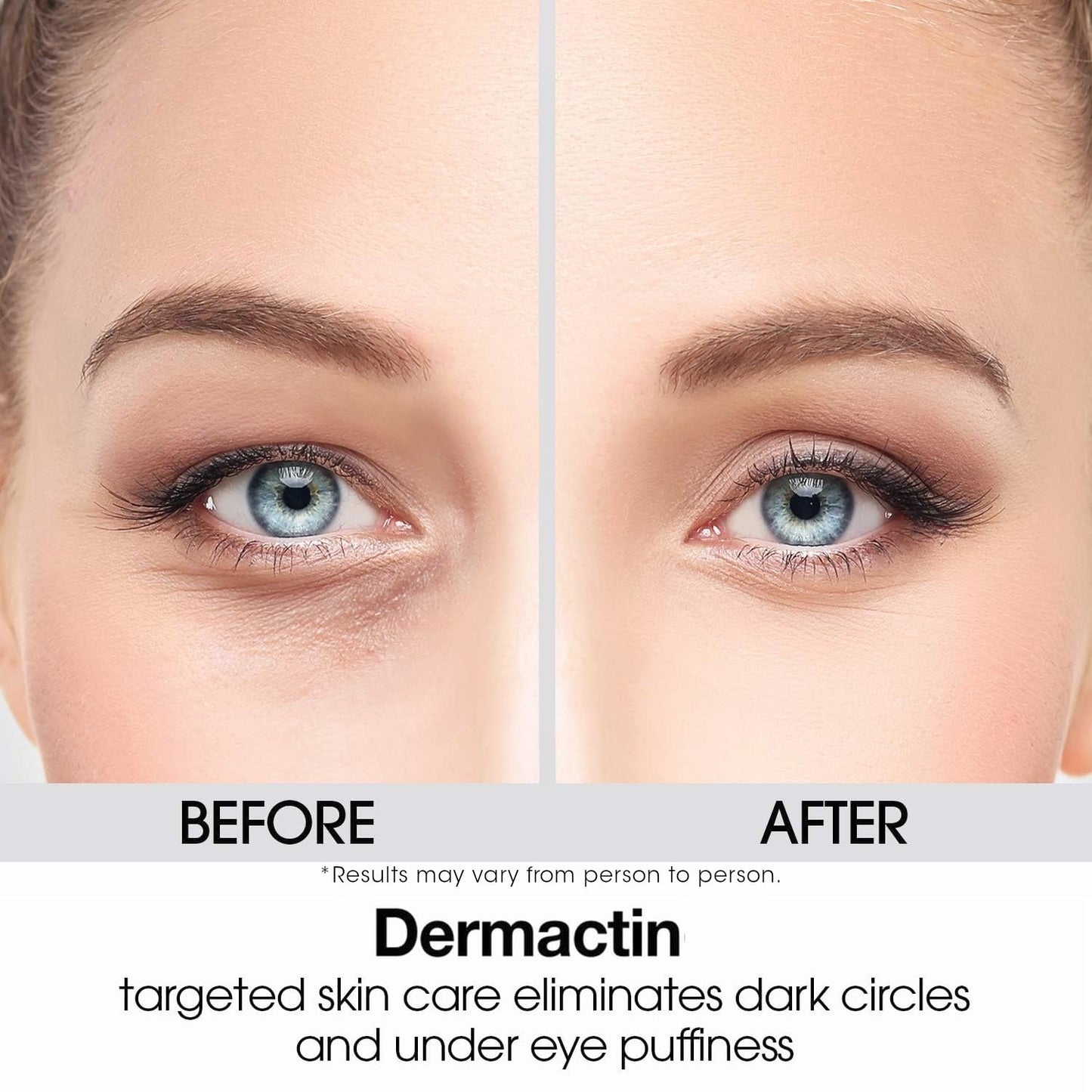 Dermactin Upper Eyelid Cream 1 oz – Firms & Tones Sagging Lids, Reduces Droop, Brightens Eyes, Gentle for Sensitive Skin