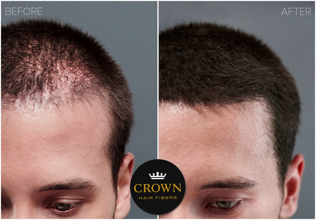 CROWN Hair Building Fibers 28g – Instantly Conceals Thinning Hair for Fuller, Thicker Look – Natural Keratin Hair Concealer for Men & Women, Black