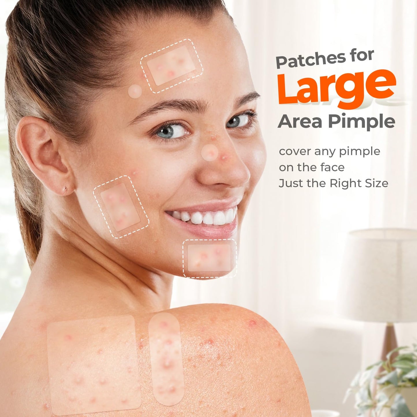 Large Pimple Patches for Face & Body – 7 Sizes XL Hydrocolloid Acne Bandages for Chin, Forehead, Nose, Back – 142 Count (Square, Strip, Dot)