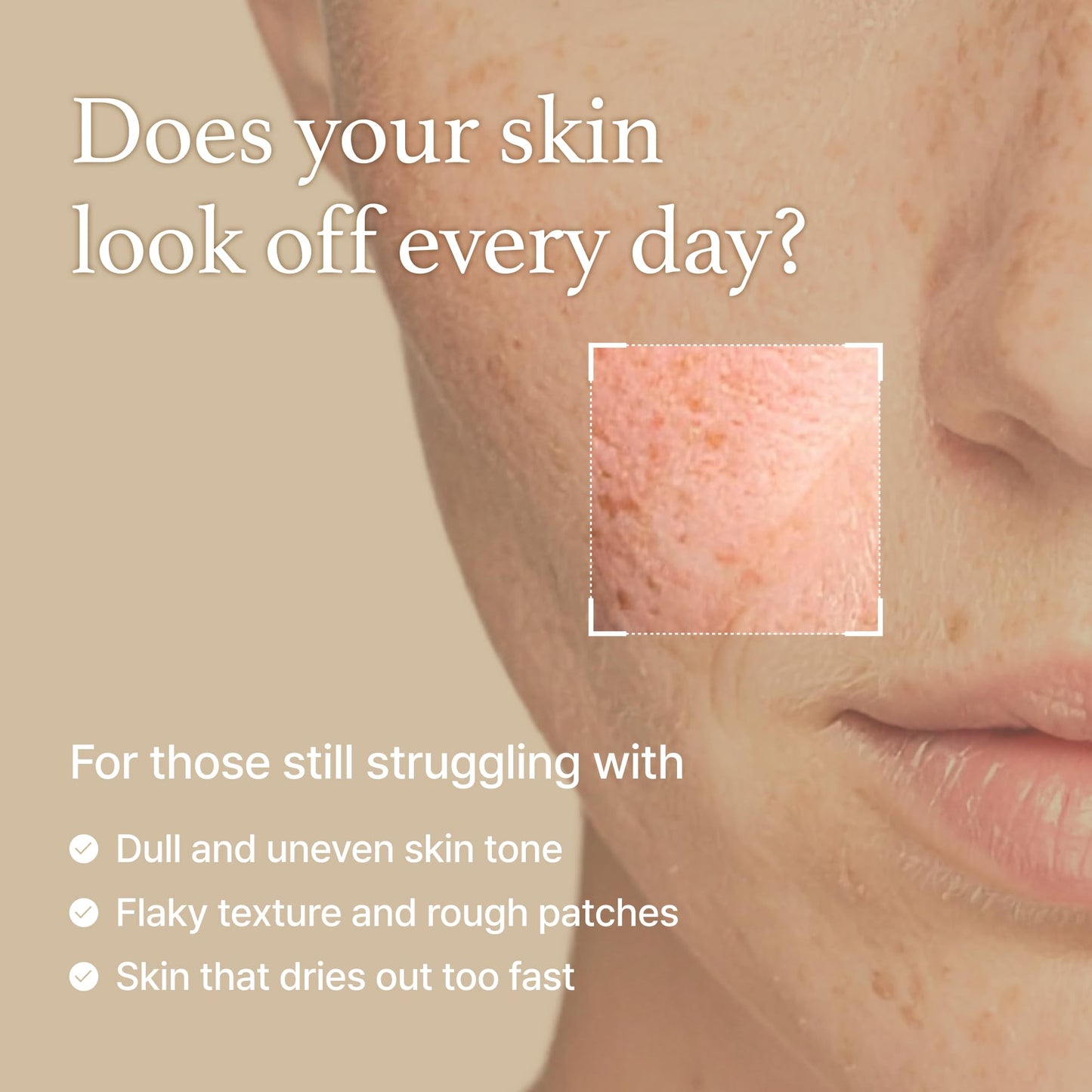 I'm From Rice Toner for Sensitive Skin – Hydrating K-Beauty Essence with Niacinamide & Rice Extract, Vegan, Alcohol & Fragrance Free, 5.07 oz