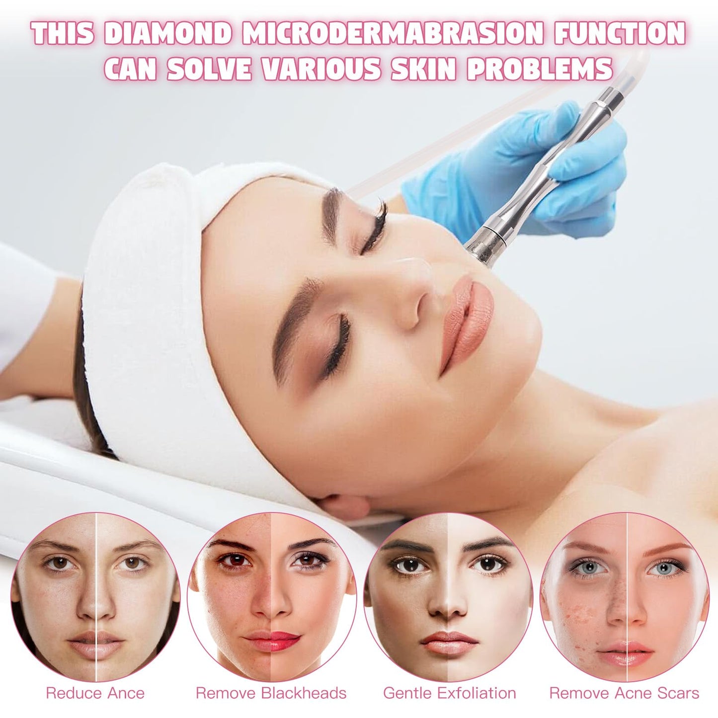 【3 IN 1 】Microdermabrasion Machine, Beauty Star Professional Diamond Dermabrasion Facial Devices at Home