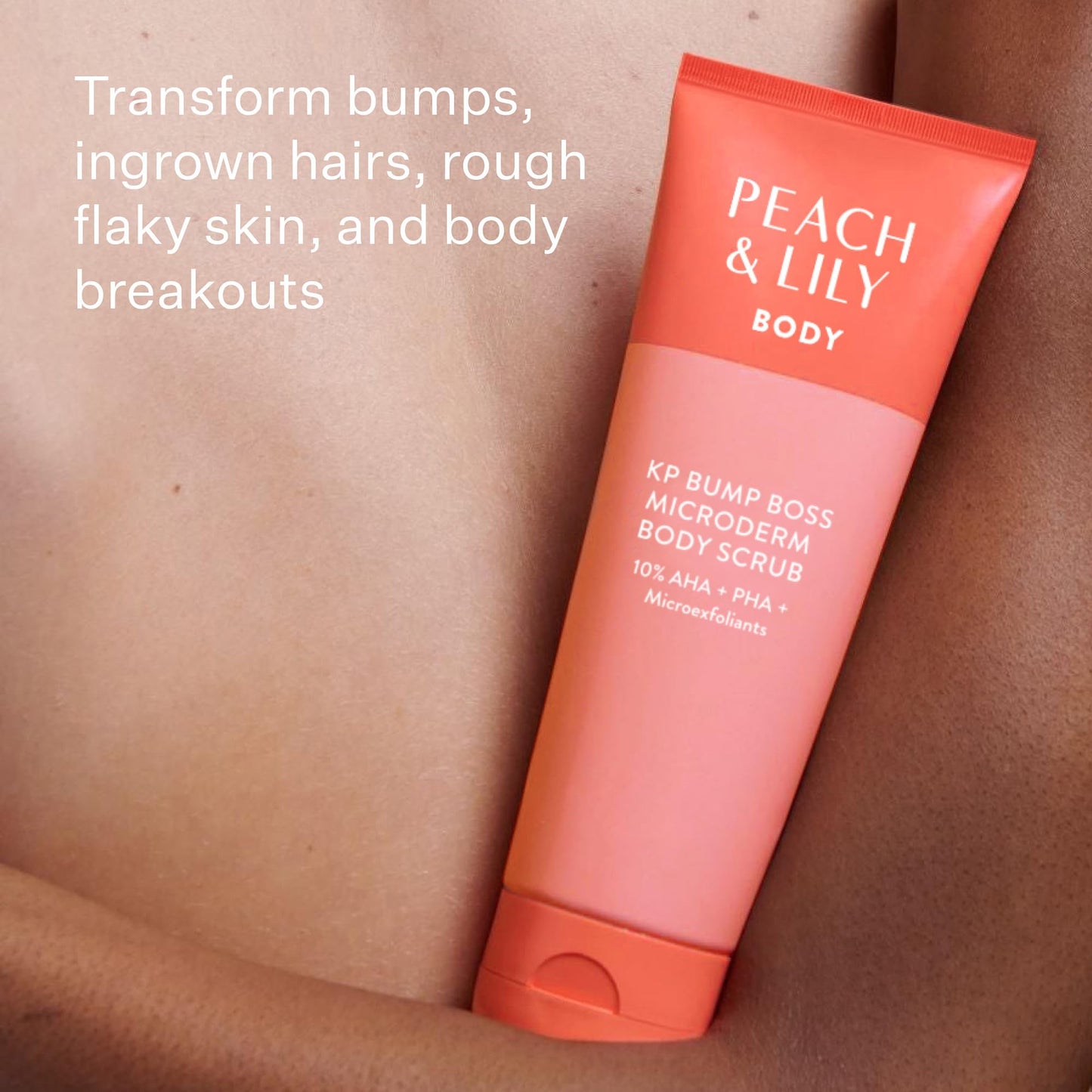 Peach & Lily KP Bump Boss Microderm Body Scrub, 10% AHA (Glycolic & Lactic Acid) | Smooth, Radiant Skin | Clean & Cruelty-Free 8.11oz