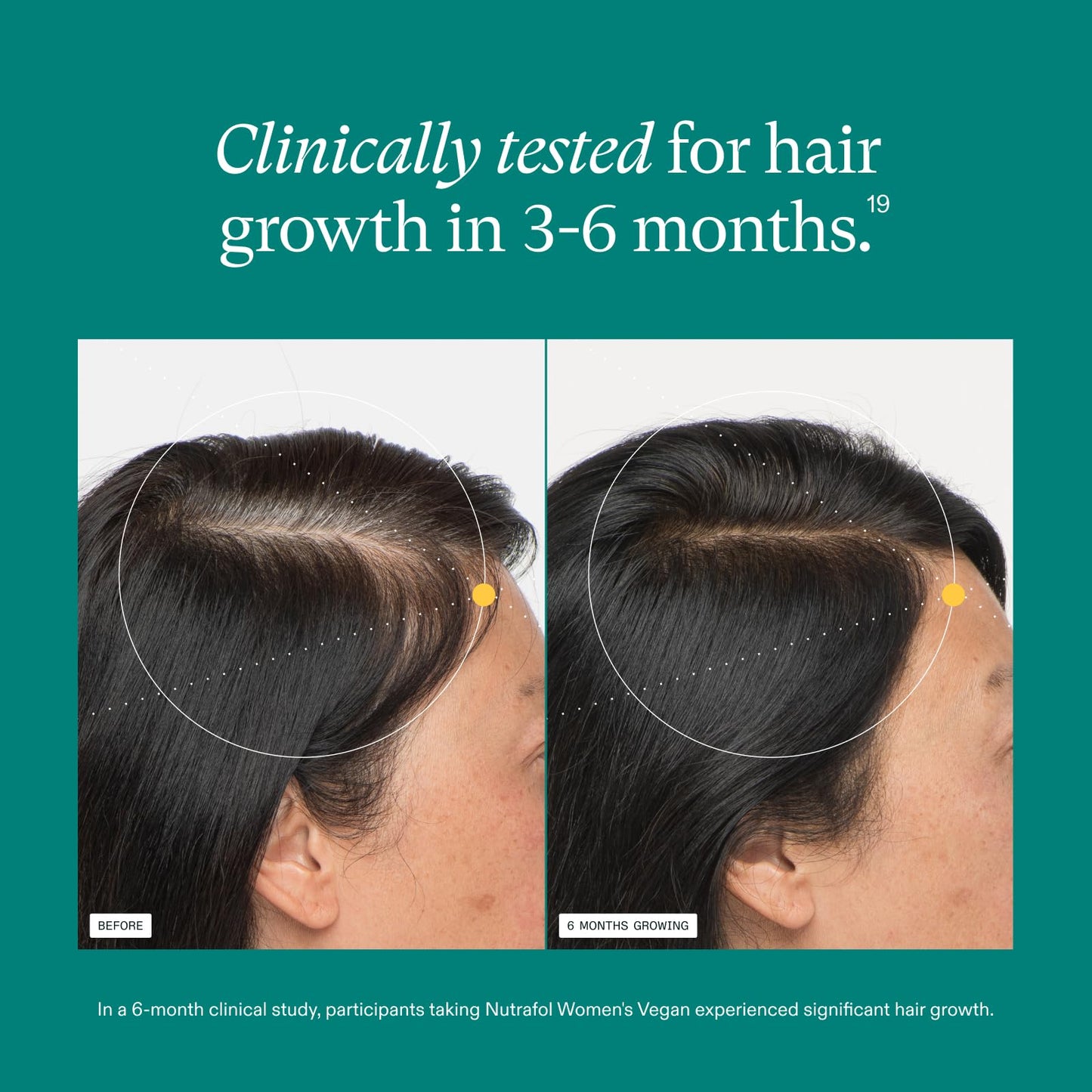 Nutrafol Women’s Hair Growth Supplement | Clinically Tested for Thicker, Stronger Hair | 100% Vegan, Dermatologist Recommended | 1-Month Supply