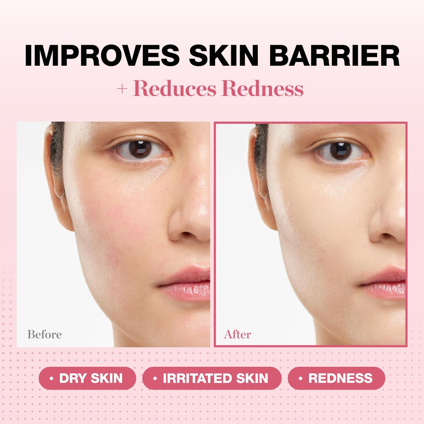 Physiogel Redness Reducing Cream – Ceramide Moisturizer for Sensitive, Redness-Prone Skin, Repairs Barrier, Fragrance-Free, 3.4 fl oz