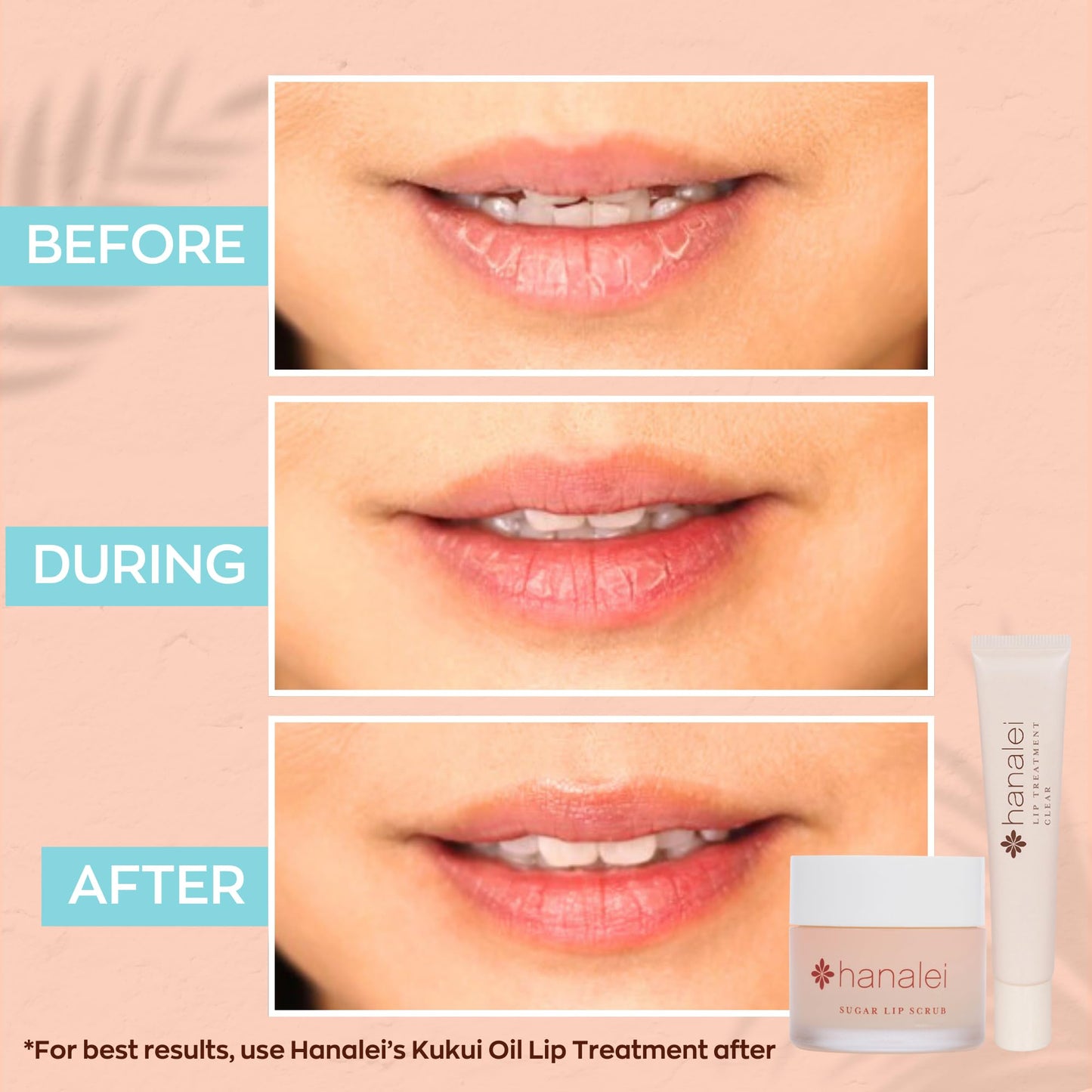 Hanalei Vegan Sugar Lip Scrub, 22g – Hawaiian Cane Sugar, Kukui Oil & Shea Butter, Natural, Cruelty-Free, Smooths & Hydrates Lips