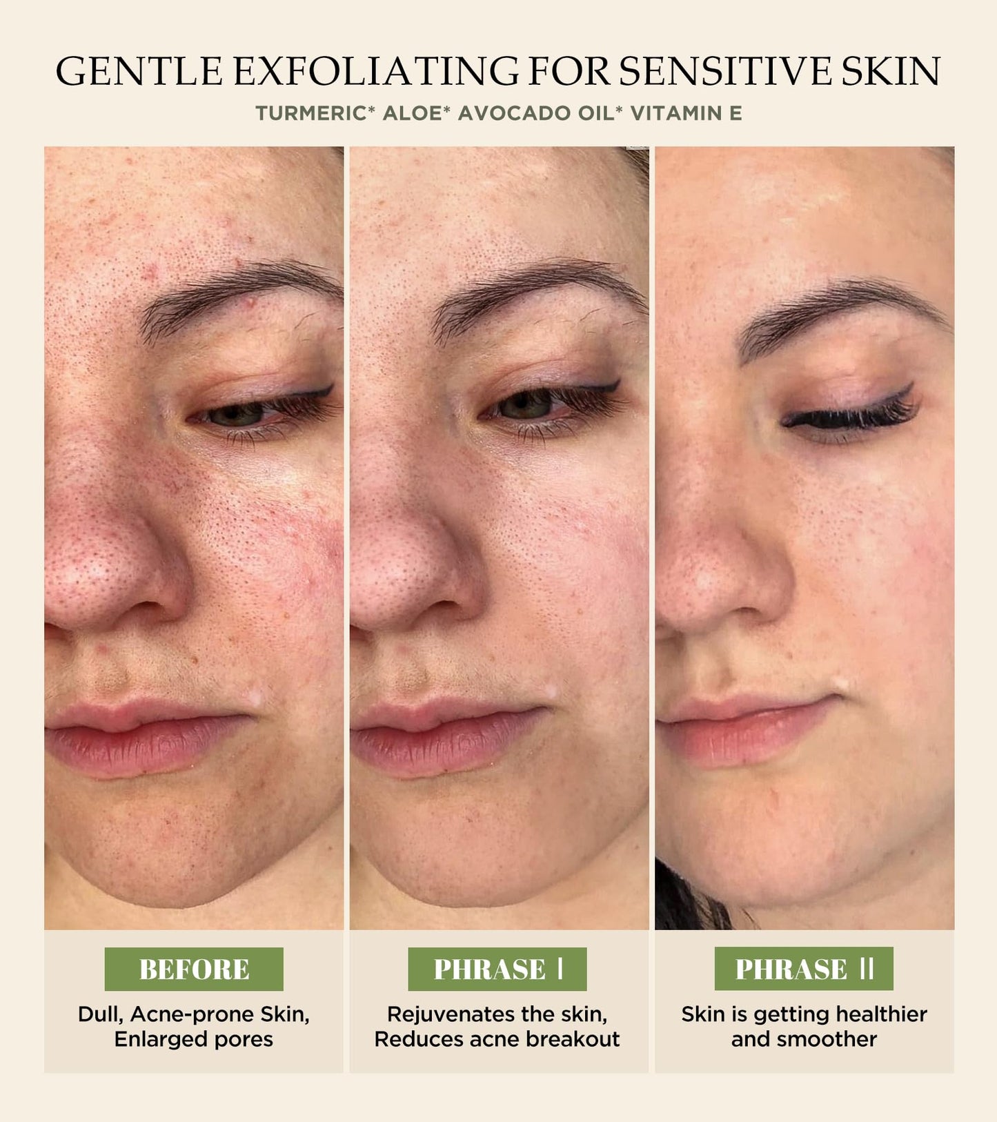 Vitamin C & Turmeric Face Scrub โ Exfoliating Scrub for Face & Body, Anti-Aging, Clears Blackheads & Dark Spots, All Skin Types, 4.23 oz