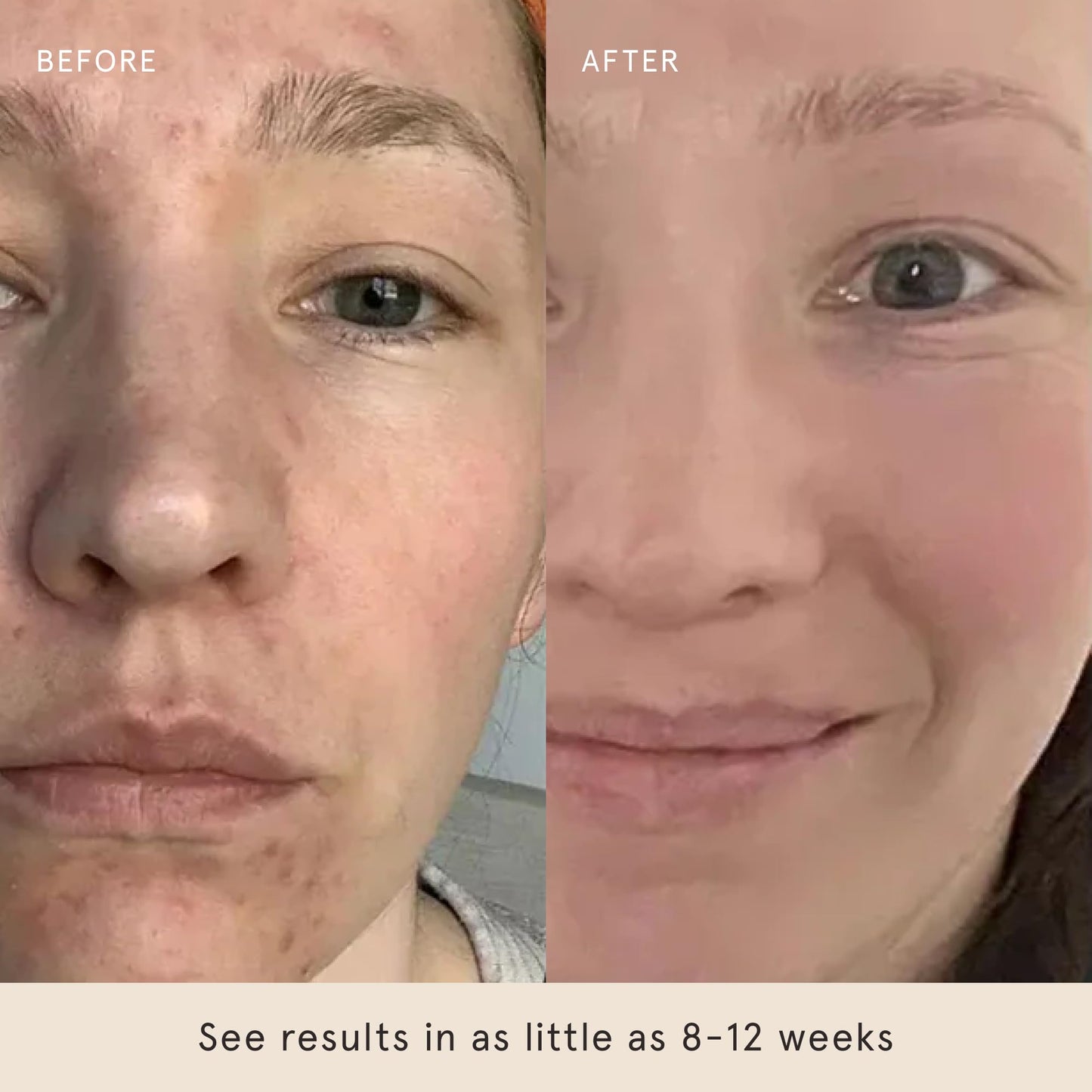 Barefaced Glow Peel Pads, 60 Ct – 15% Glycolic Acid Exfoliating Face & Body Pads with Squalane & Vitamin E for Smooth, Clear Skin