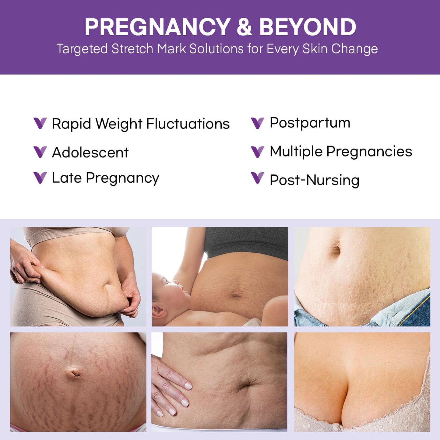 Stretch Mark Cream for Pregnancy - Belly Butter & Massage Lotion to Prevent & Repair Maternity Stretch Marks, 4 oz