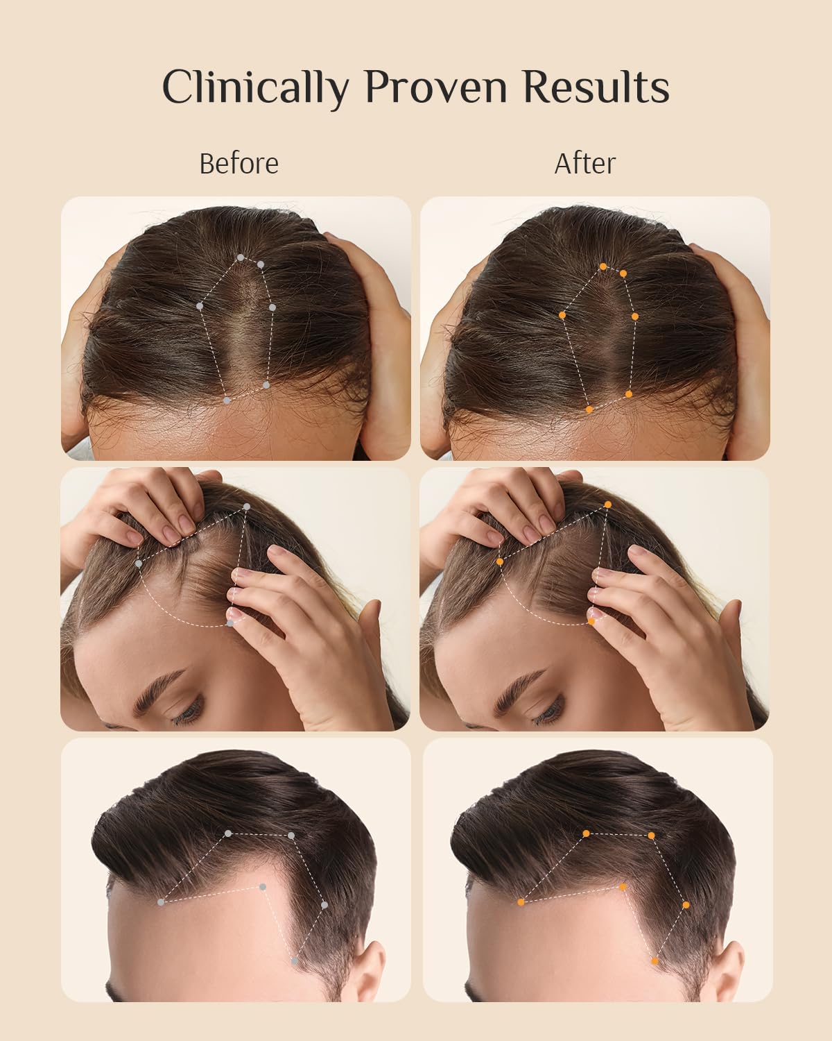 DR ZERO NEOLOGY Hair Growth Conditioner for Women, 13.5 oz – Volumizing & Thickening Formula with Redensyl, Anti Hair Loss & Regrowth Treatment