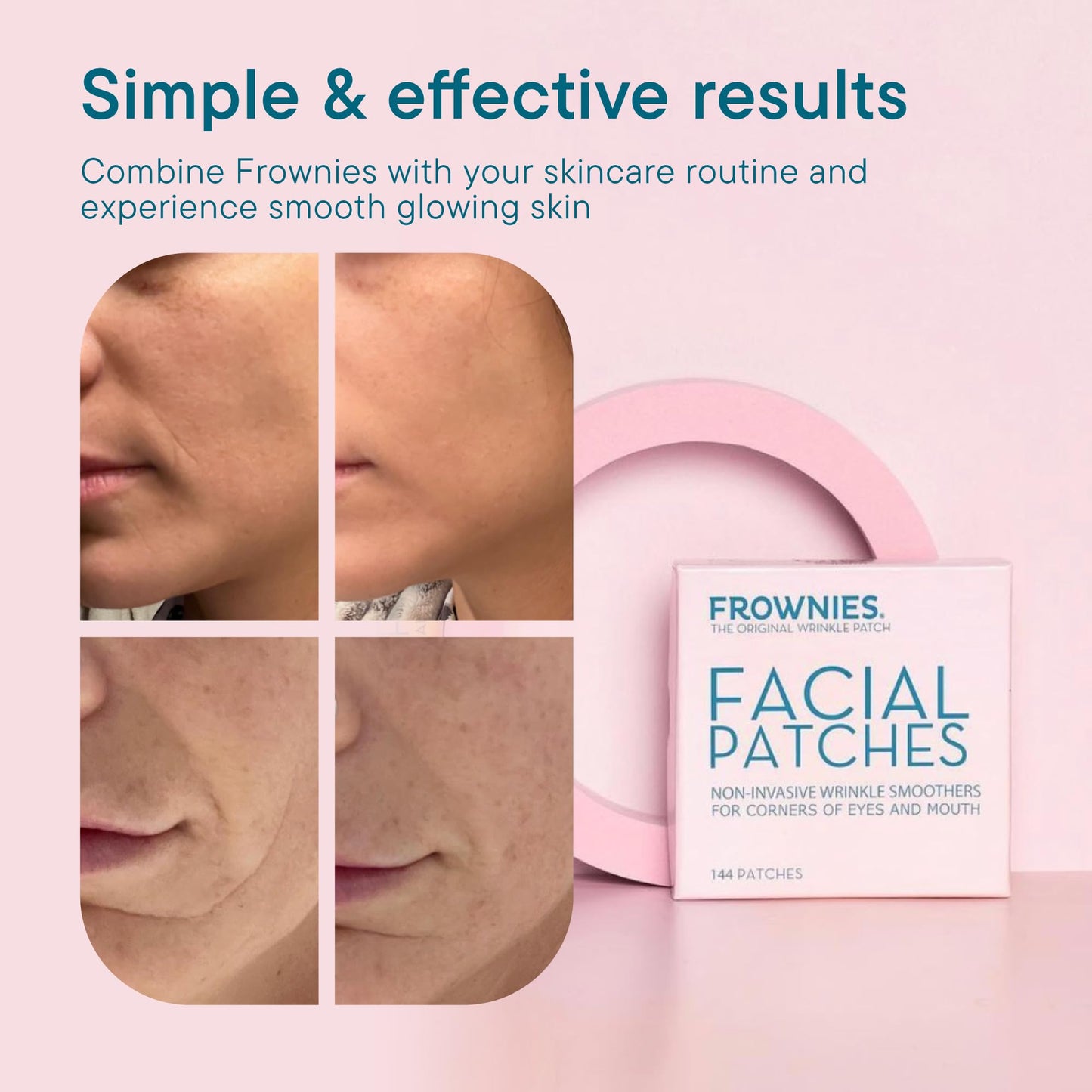 Frownies Anti-Wrinkle Facial Patches for Eyes & Mouth, Hypoallergenic, Smooth Crow’s Feet & Smile Lines Overnight, 144 Patches