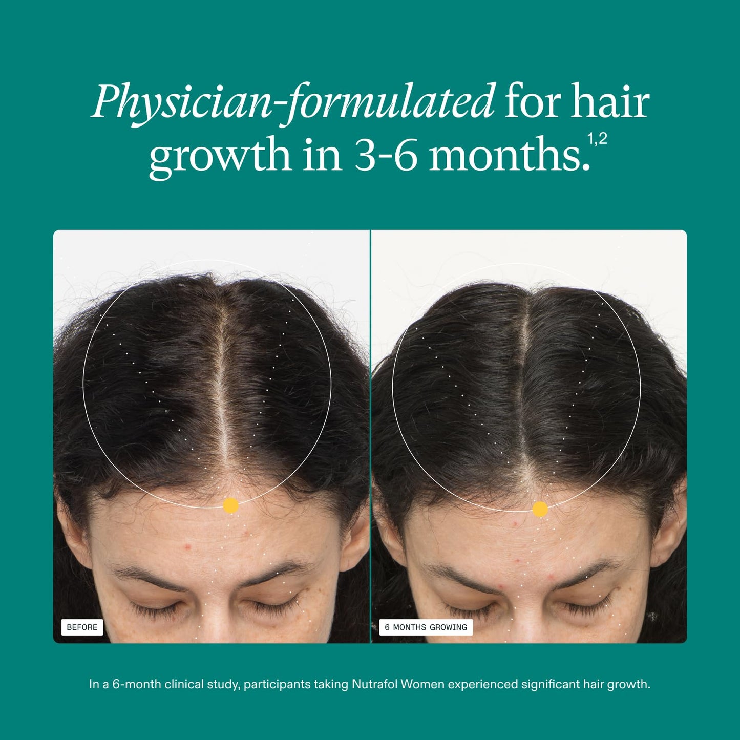 Nutrafol Women’s Hair Growth Supplement Refill | Clinically Proven for Thicker, Stronger Hair | Dermatologist Recommended | 1-Month Supply