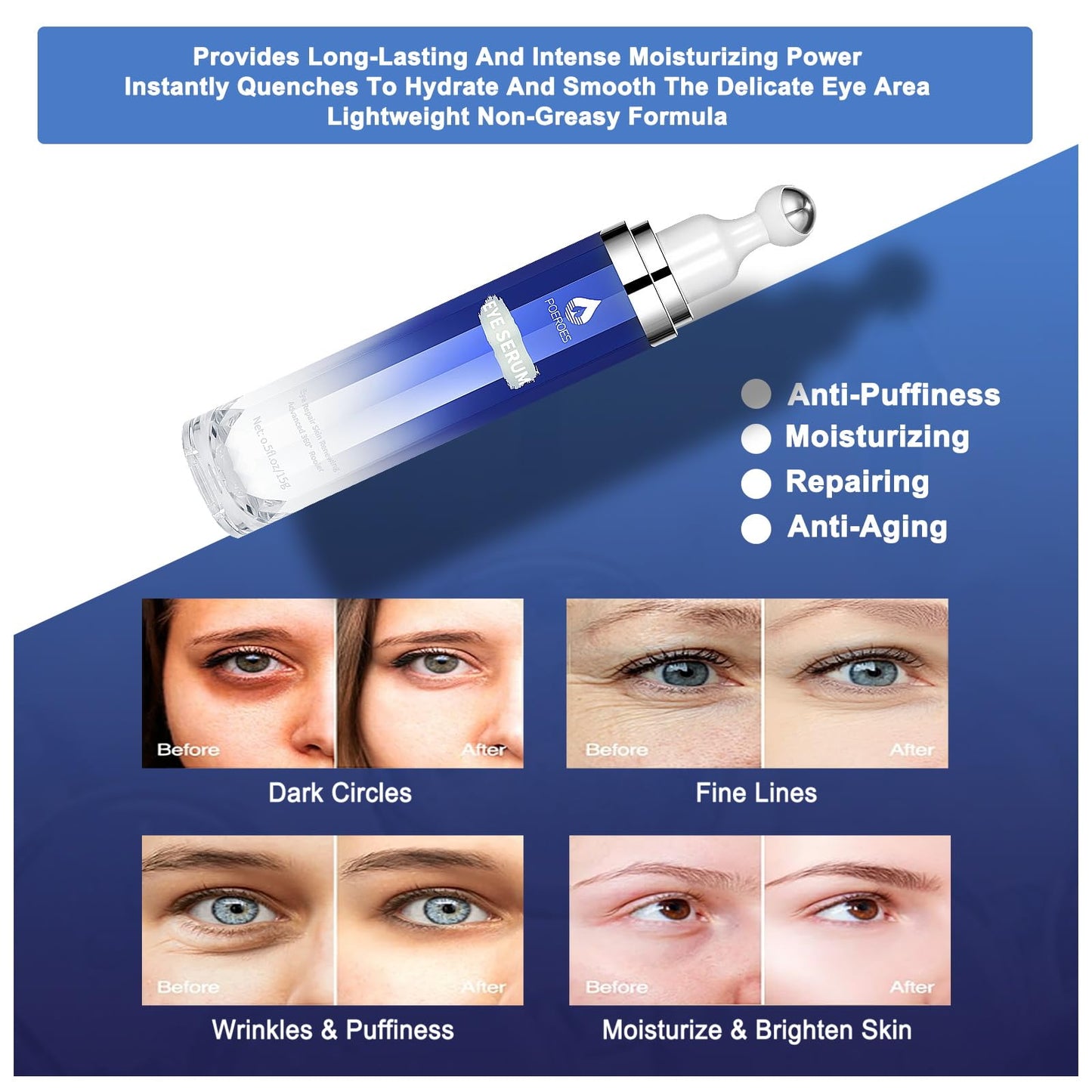 Eye Serum with 8% Caffeine & Retinol, Hyaluronic Acid, Niacinamide & Peptides for Dark Circles, Puffiness, Fine Lines, 360° Roller, 0.5 oz