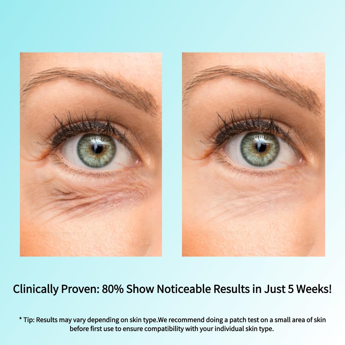 SEACALL Retinol Eye Cream with Caffeine, Hyaluronic Acid & Vitamin C – Anti-Aging, Dark Circles & Puffiness Treatment, 15ml