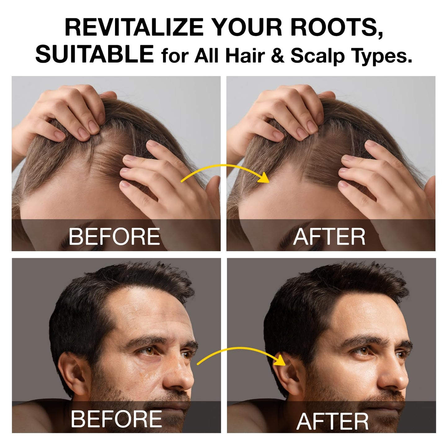 Root Activator Shampoo for Men: Hair Growth Shampoo for Hair Loss and Thinning Hair - 10.1 fl oz / 300 mL