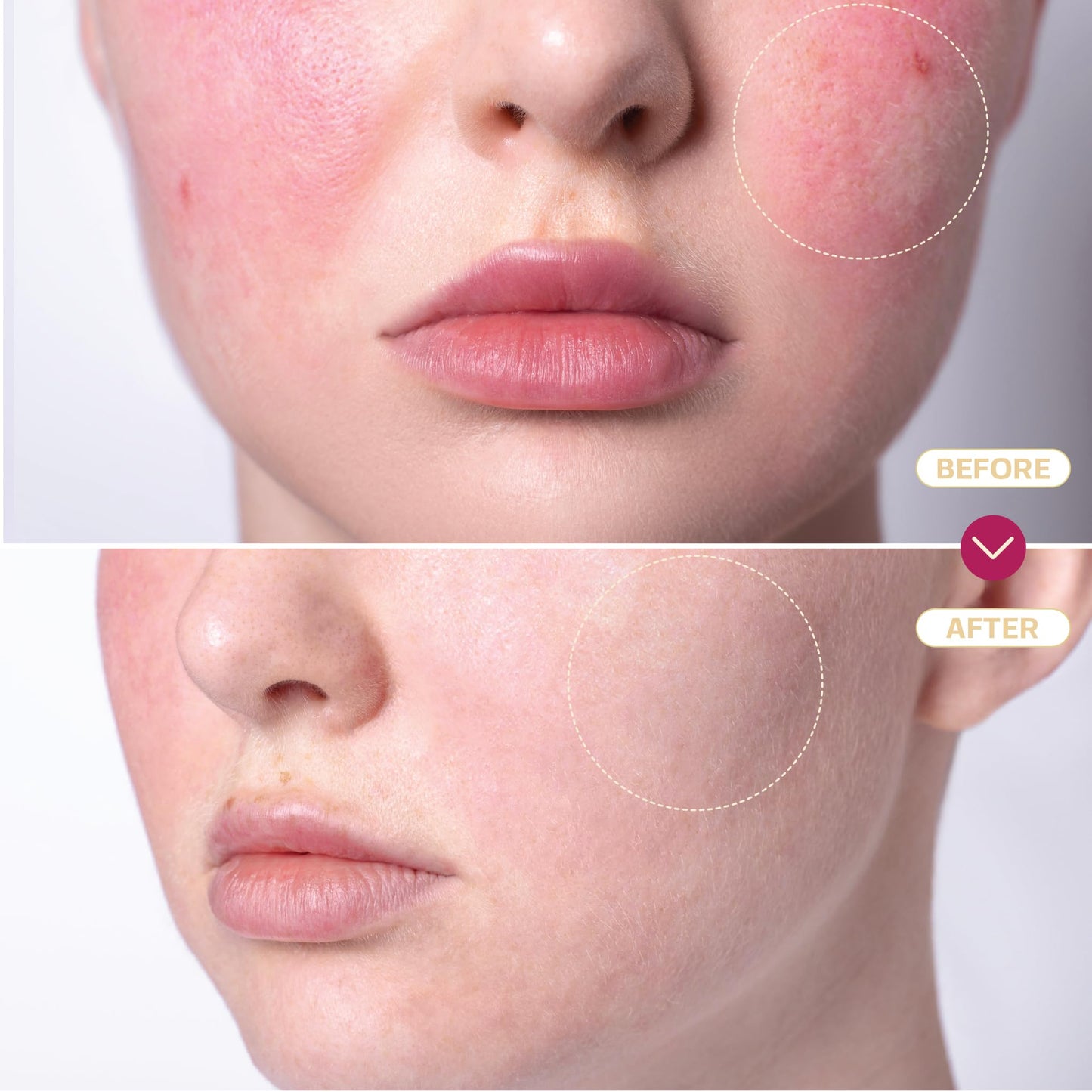 BASE LABORATORIES Hypochlorous Acid Spray for Face & Skin, 8 oz – Daily Repair for Sensitive Skin, Redness, Irritations, Acne & Eczema