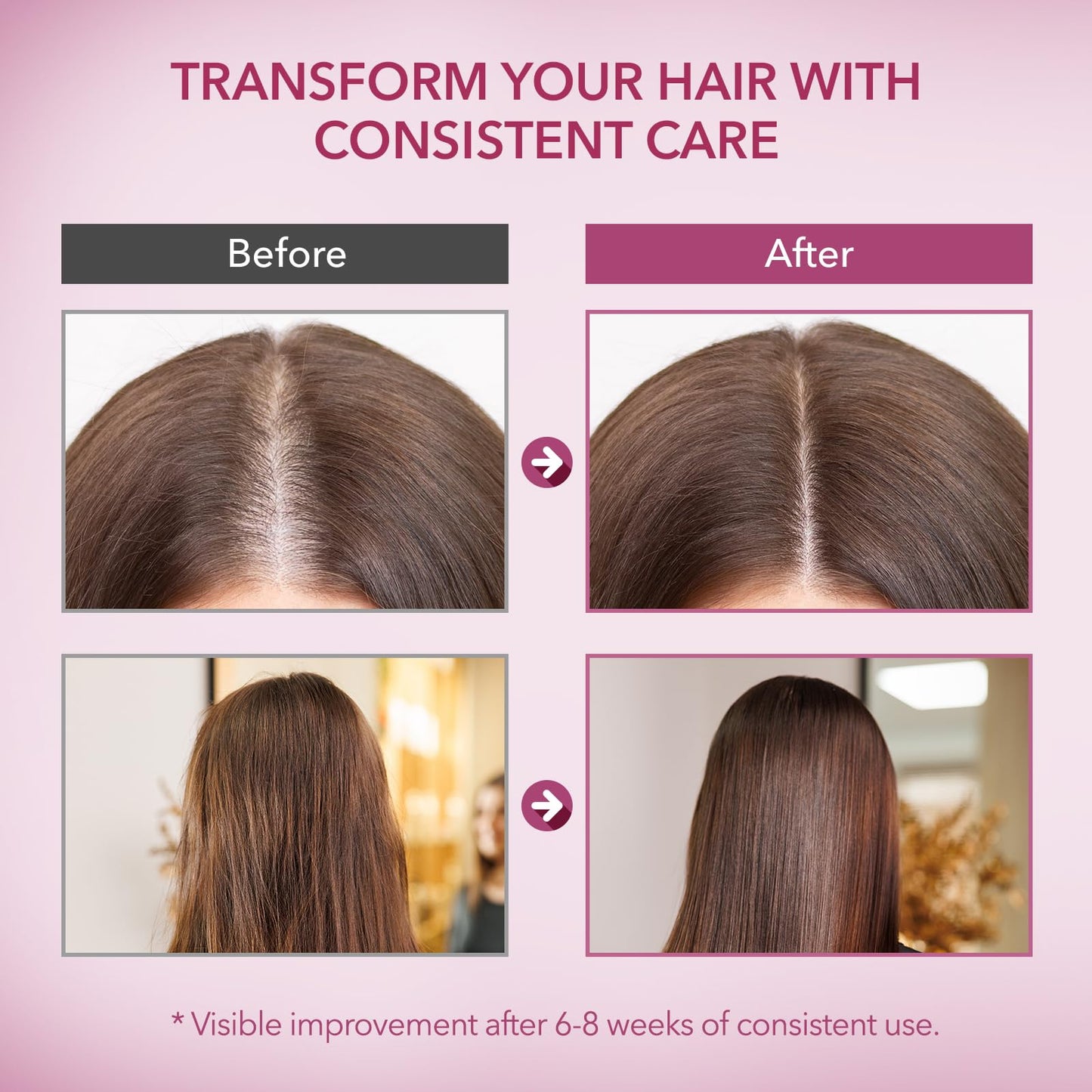 Onion & Rosemary Hair Growth Shampoo with Biotin – Strengthens Roots, Reduces Hair Loss & Thinning, Promotes Thicker, Healthier Hair (16.9 Fl Oz)