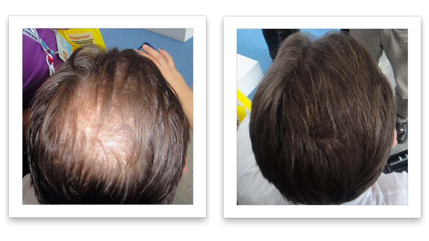 Caboki Hair Building Fiber 16G (Dark Brown)