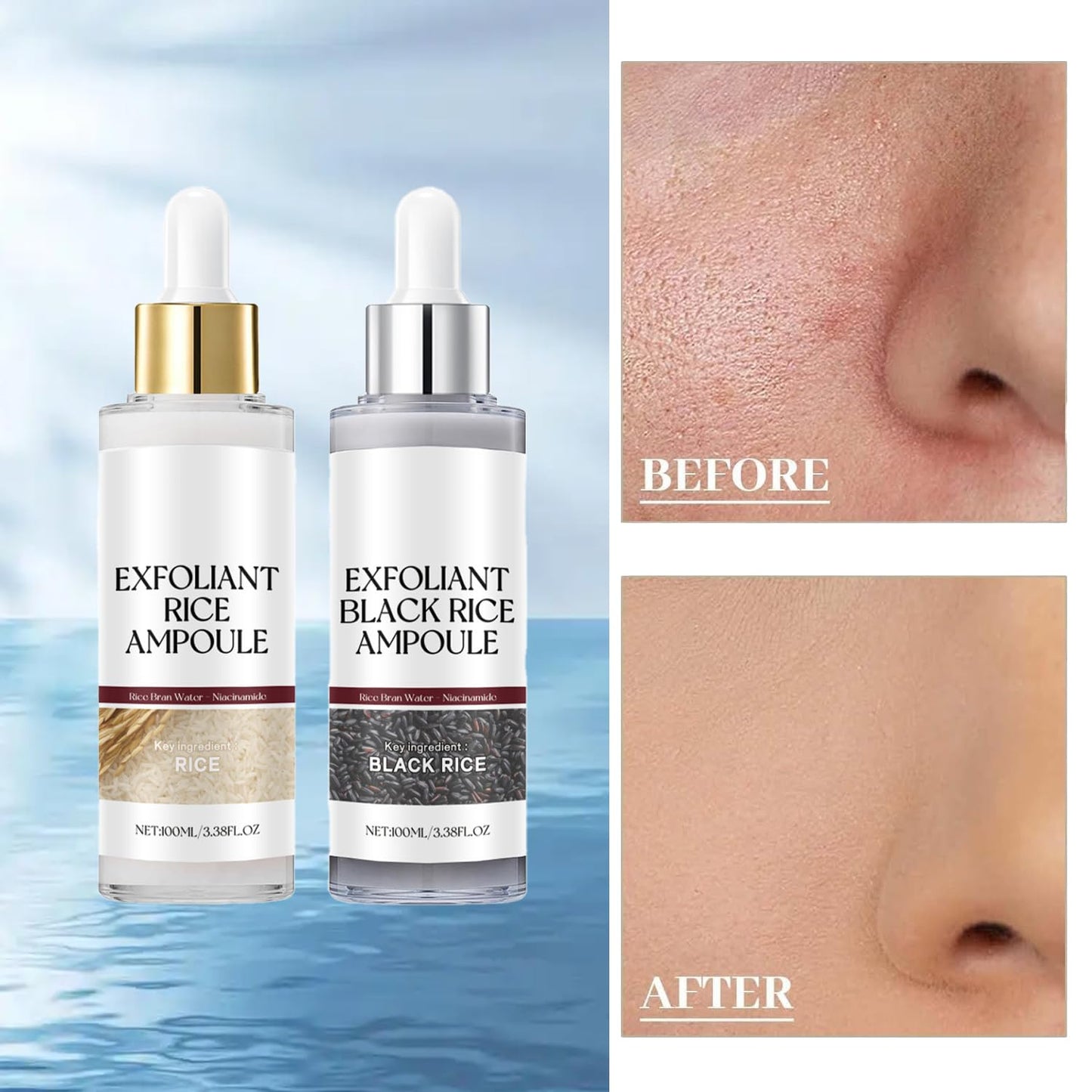 Black & White Rice Exfoliating Peel for Face & Body – Gentle Soft Scrub, Deep Hydration, Suitable for All Skin Types, 2-Pack