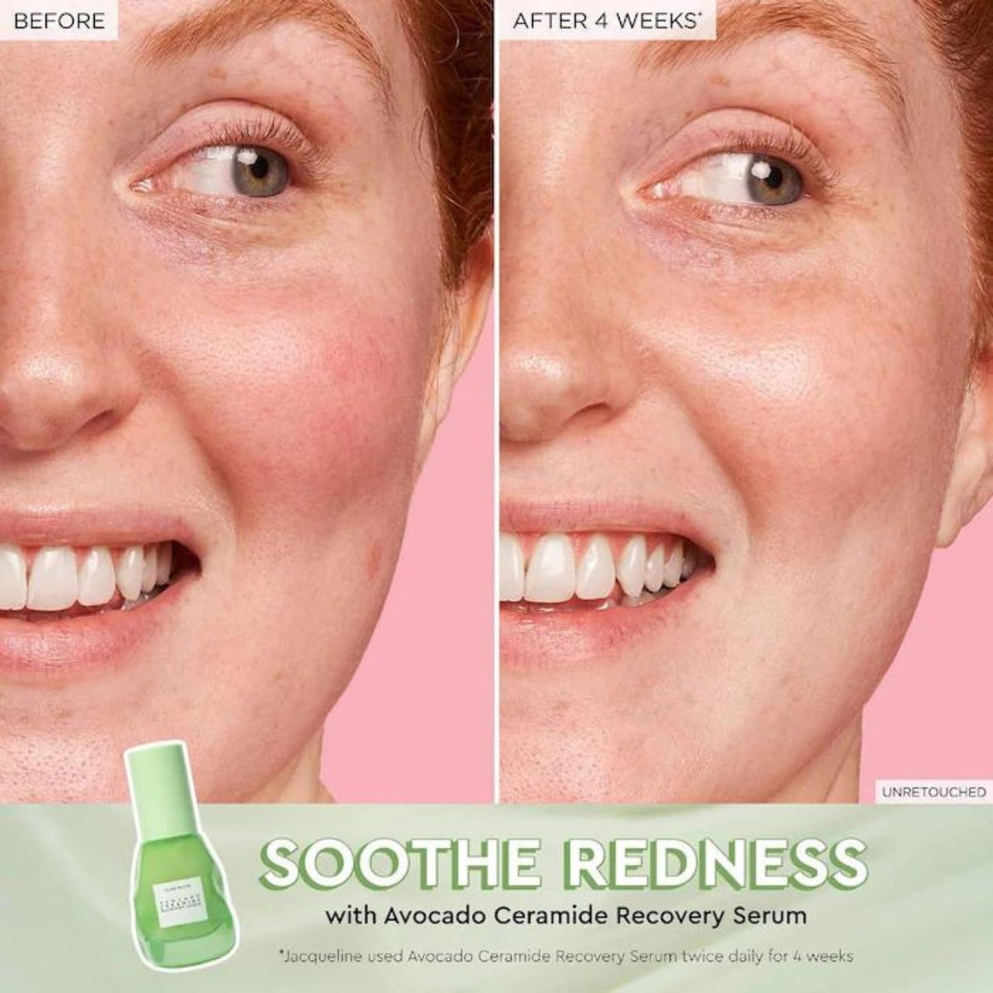 Glow Recipe Soothe, Glow & Bright 3-Piece Gift Set – Niacinamide Primer, Avocado Ceramide Serum & Guava Dark Spot Serum